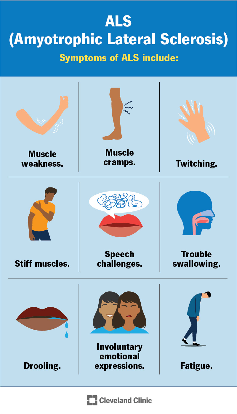 Common symptoms of ALS include muscle weakness, tremors and speech challenges